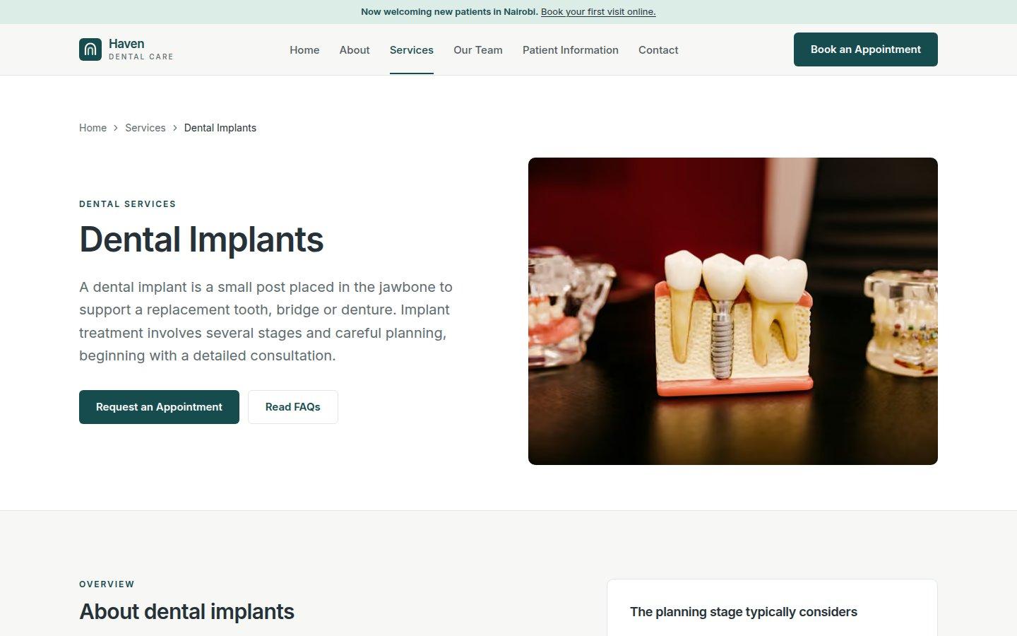 A service page